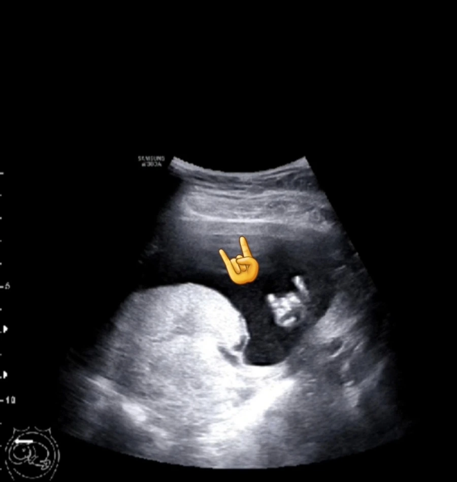 Screenshot_20230604_213005_Instagram.jpg?type=w1