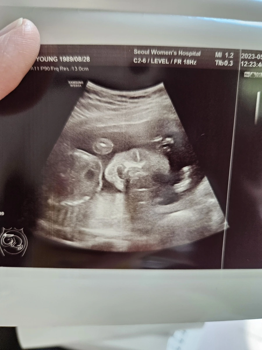 20230512_145157.jpg?type=w1