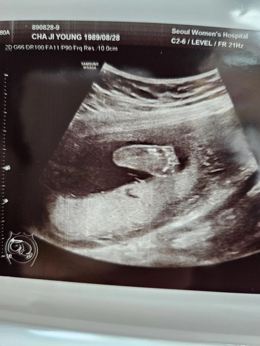 20230512_145125.jpg?type=w1