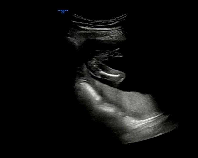 Screenshot_20230607_165859.jpg?type=w1