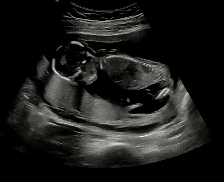 Screenshot_20230607_165507.jpg?type=w1