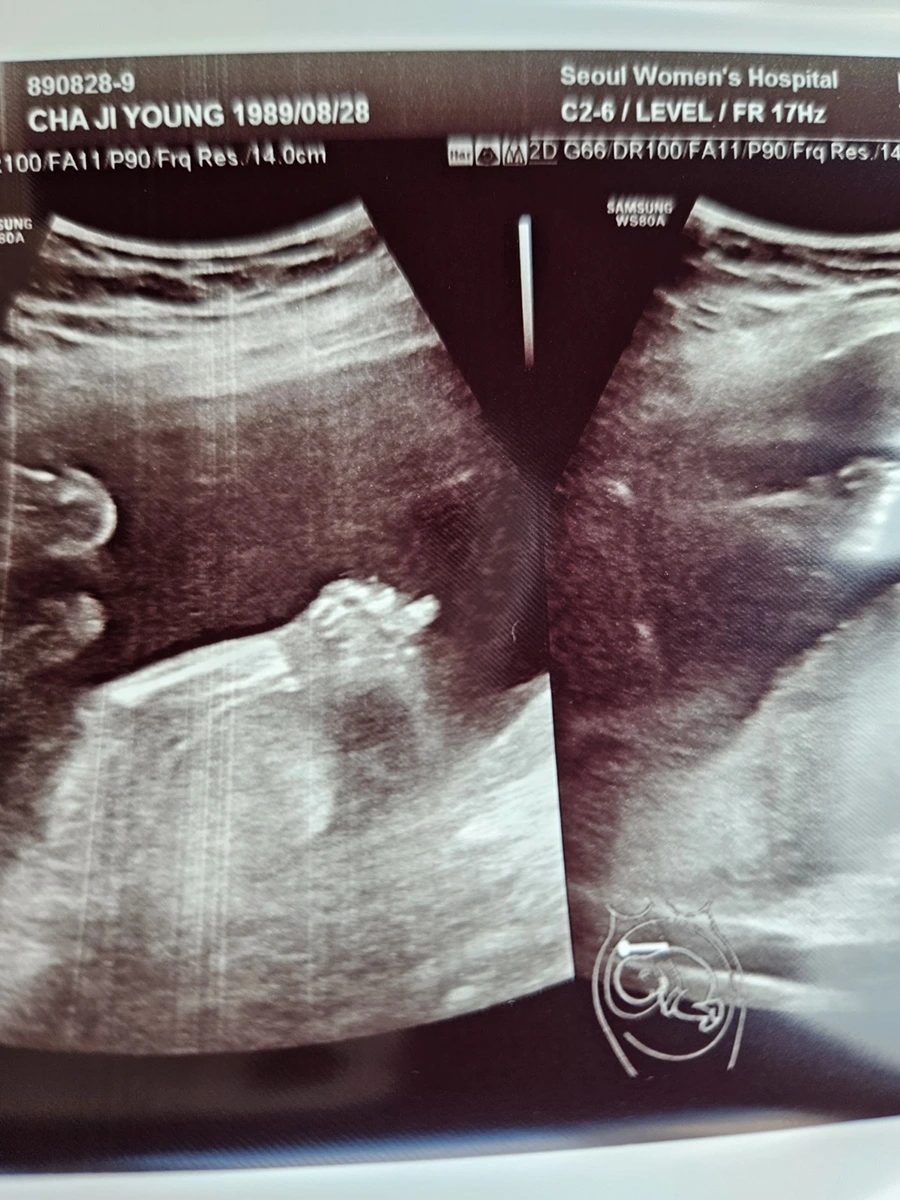 20230512_145142.jpg?type=w1