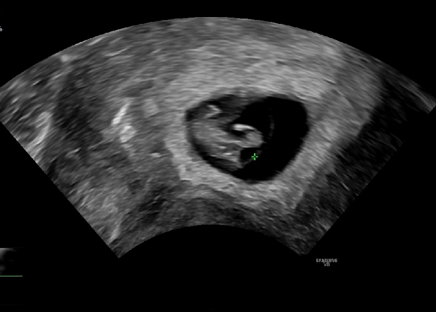 KakaoTalk_20230530_142435314_01.jpg?type=w1