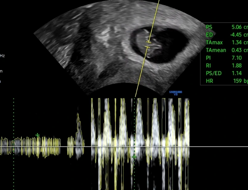 KakaoTalk_20230530_142435314.jpg?type=w1