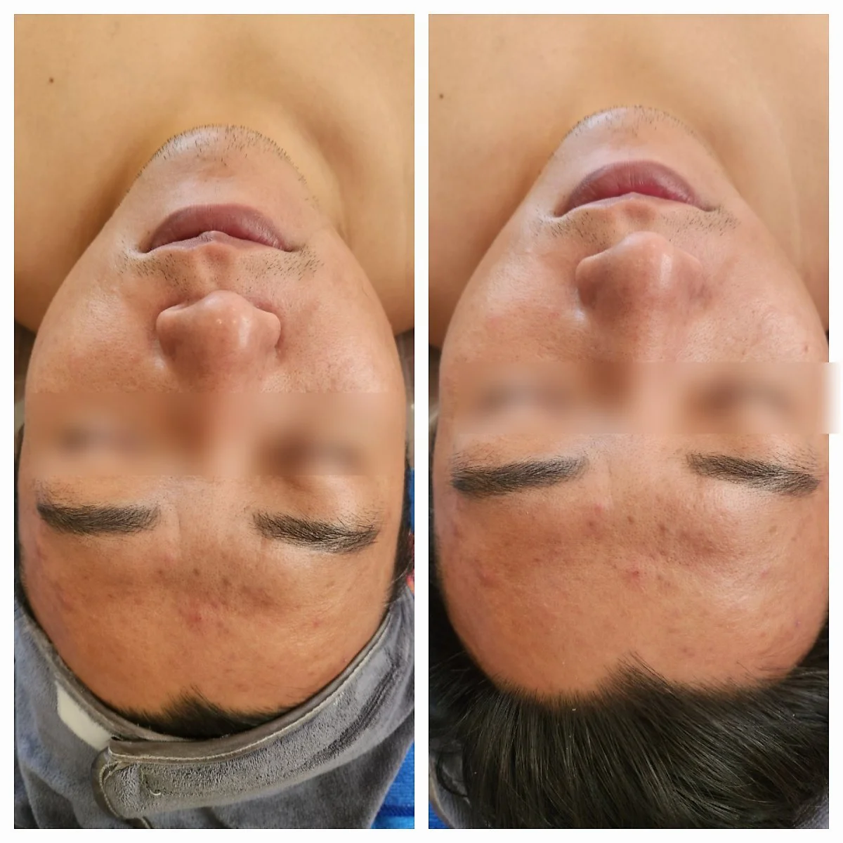 image_6546712621682320405587.jpg?type=w1200