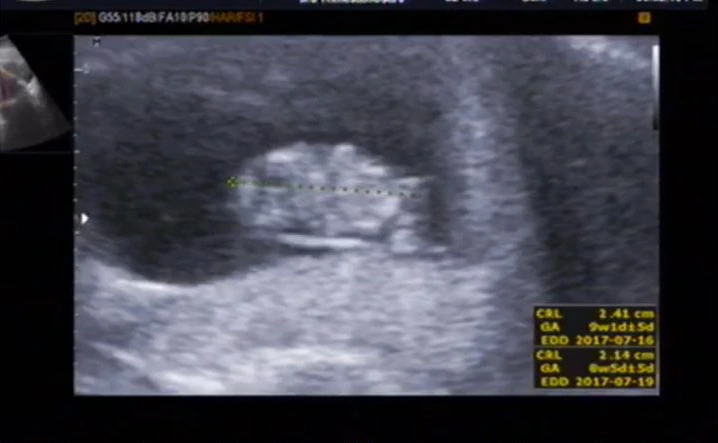 KakaoTalk_Photo_2016-12-14-00-36-59.jpg?type=w1