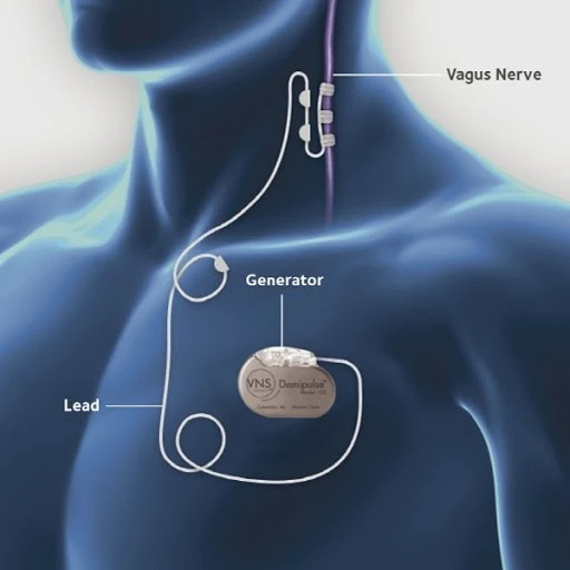 ?src=http%3A%2F%2Fblogfiles.naver.net%2FMjAyMDA4MTNfMTM4%2FMDAxNTk3MjUwMzMwNzI1.wsgqq313qvQoBDQ-509uOPpN4t82vX59L31MsKM6FS8g.ql0Ves3hWbKNw7PeypNIsyxQWFbMQSv9IYs705y30z4g.JPEG.mwiyom%2Funnamed_%25282%2529.jpg&type=sc960_832