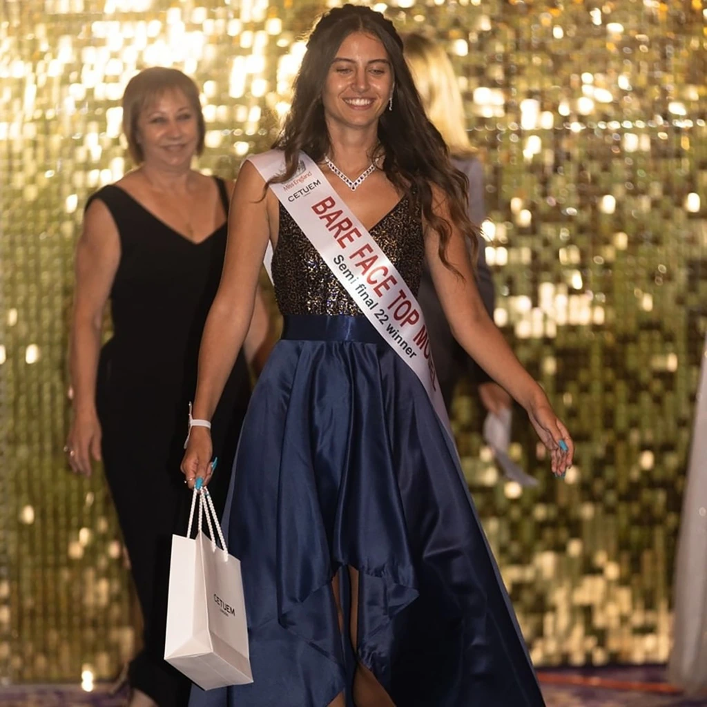 miss-england-no-makeup-06.jpg?w=1024