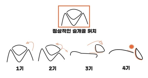 %EC%8A%AC%EA%B0%9C%EA%B3%A8%EC%9C%84%EC%B9%98.jpg?type=w966