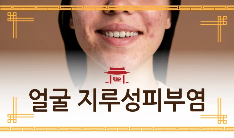 231129_%EC%A7%80%EB%A3%A8%EC%84%B1%ED%94%BC%EB%B6%80%EC%97%BC01.jpg?type=w966