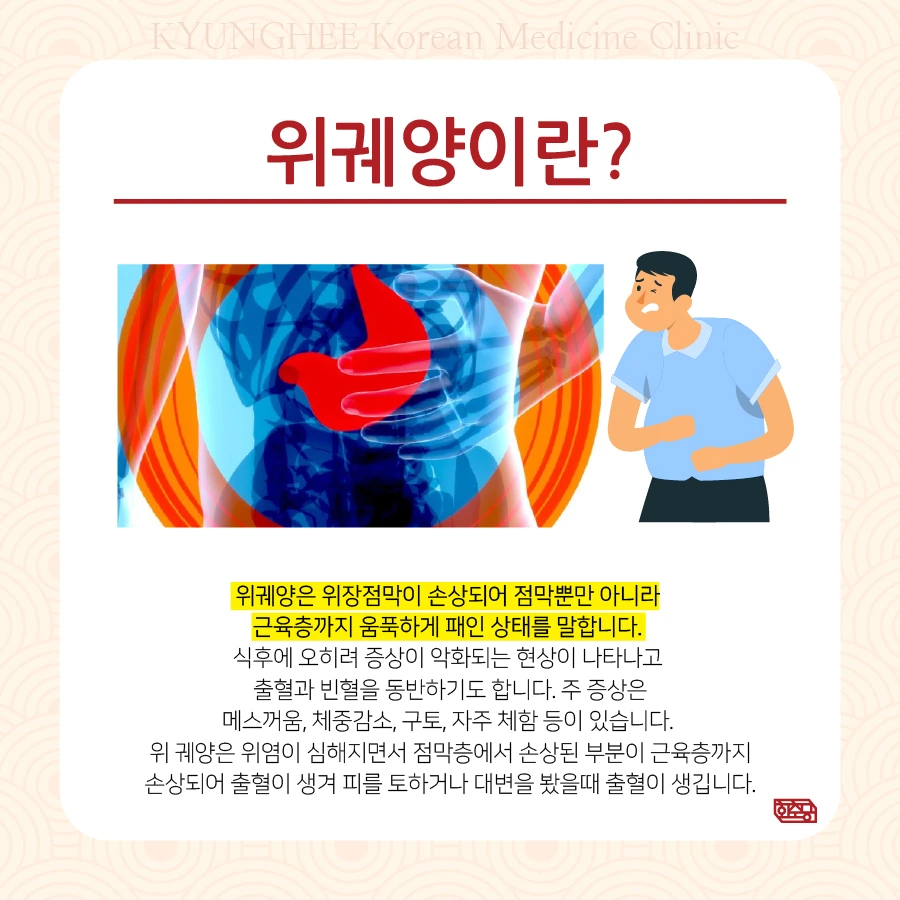 231005_%EC%9C%84%EA%B6%A4%EC%96%91%EC%9B%90%EC%9D%B8-%EA%B2%BD%ED%9D%AC%EB%A5%9802.jpg?type=w966