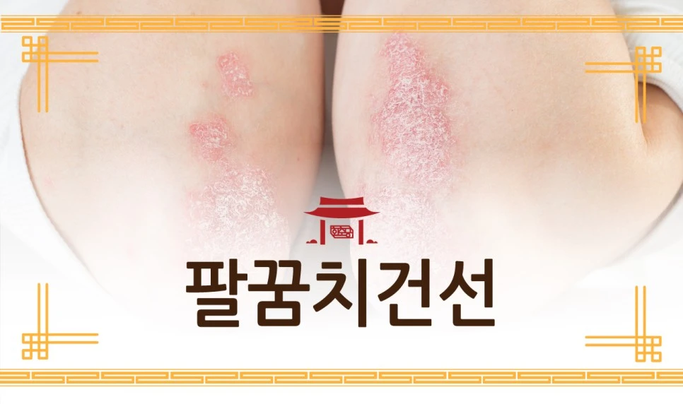 231128_%ED%8C%94%EA%BF%88%EC%B9%98%EA%B1%B4%EC%84%A001.jpg?type=w966