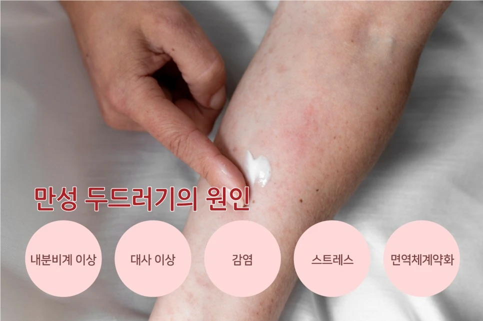 231025_%EC%9B%90%EC%9D%B8%EB%AA%A8%EB%A5%BC%EB%91%90%EB%93%9C%EB%9F%AC%EA%B8%B004.jpg?type=w966