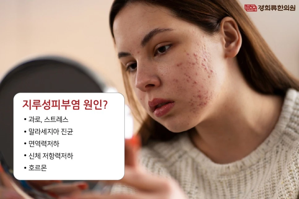 231129_%EC%A7%80%EB%A3%A8%EC%84%B1%ED%94%BC%EB%B6%80%EC%97%BC03.jpg?type=w966