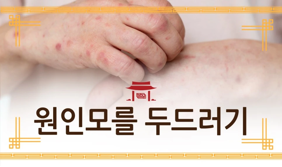 231025_%EC%9B%90%EC%9D%B8%EB%AA%A8%EB%A5%BC%EB%91%90%EB%93%9C%EB%9F%AC%EA%B8%B001.jpg?type=w966