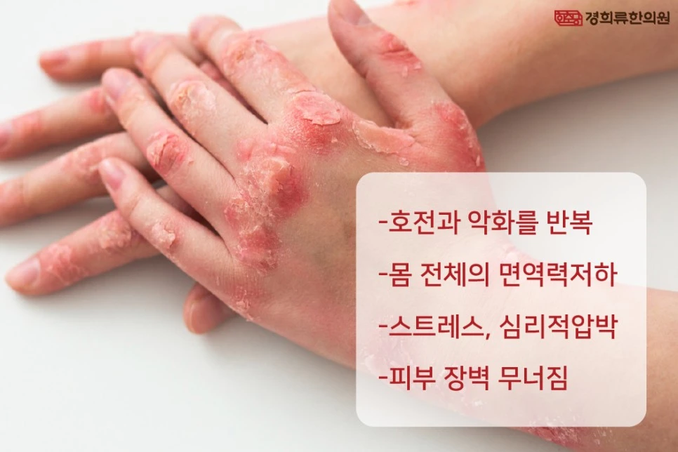 231206_%EB%8F%99%EC%A0%84%EC%8A%B5%EC%A7%8403.jpg?type=w966