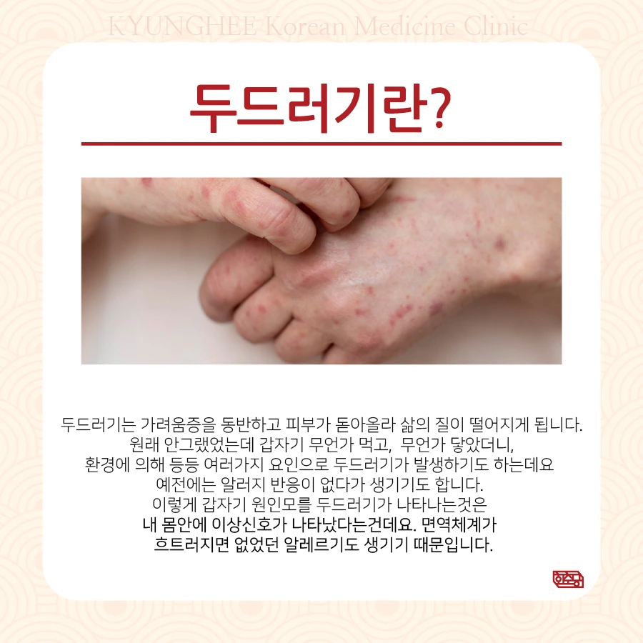 231025_%EC%9B%90%EC%9D%B8%EB%AA%A8%EB%A5%BC%EB%91%90%EB%93%9C%EB%9F%AC%EA%B8%B002.jpg?type=w966