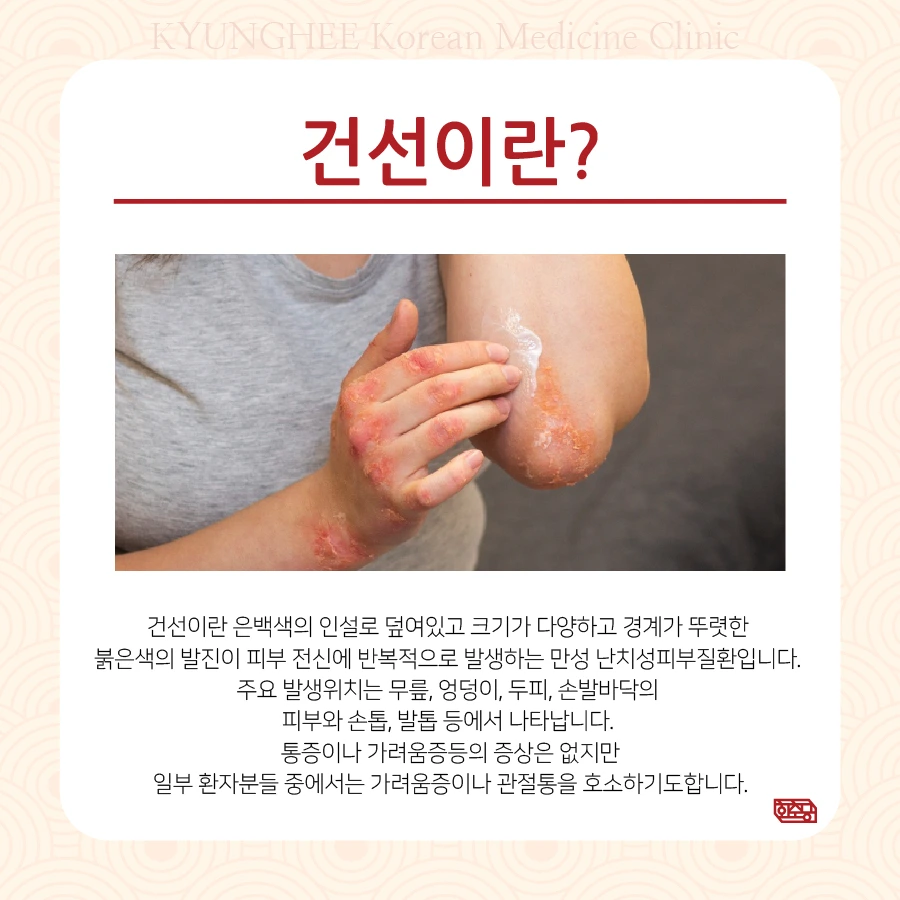 231128_%ED%8C%94%EA%BF%88%EC%B9%98%EA%B1%B4%EC%84%A002.jpg?type=w966