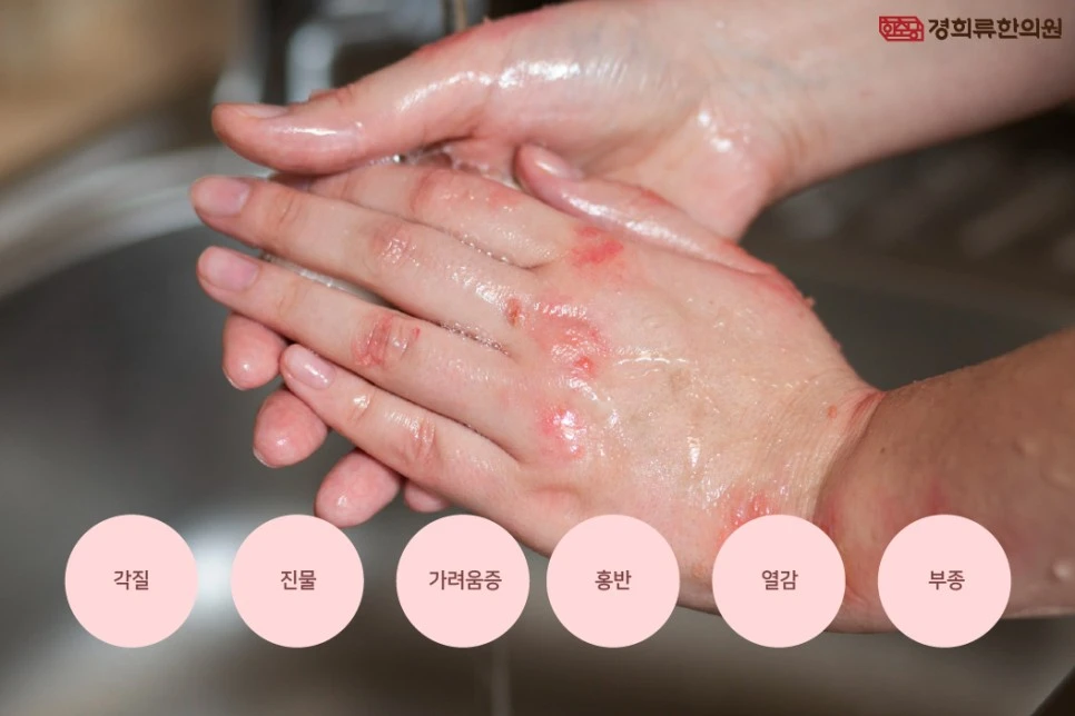 231127_%EC%86%90%EC%8A%B5%EC%A7%84%EA%B2%BD%ED%9D%AC%EB%A5%9803.jpg?type=w966