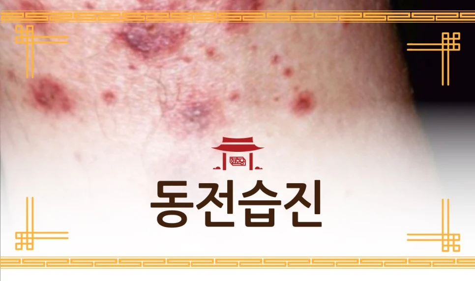 231206_%EB%8F%99%EC%A0%84%EC%8A%B5%EC%A7%8401.jpg?type=w966