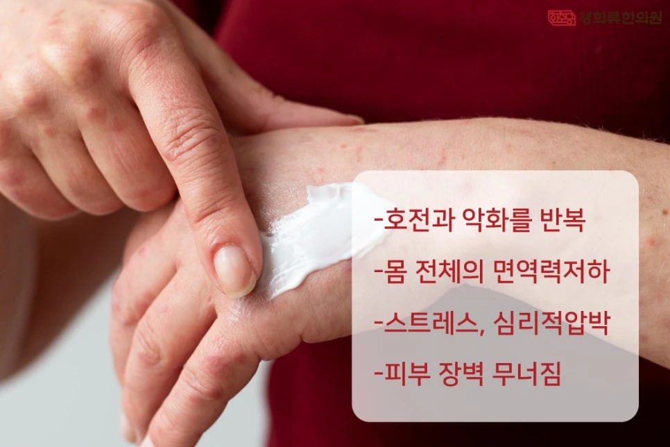 231221_%EC%84%B1%EC%9D%B8%ED%99%94%ED%8F%90%EC%83%81%EC%8A%B5%EC%A7%8403.jpg?type=w966