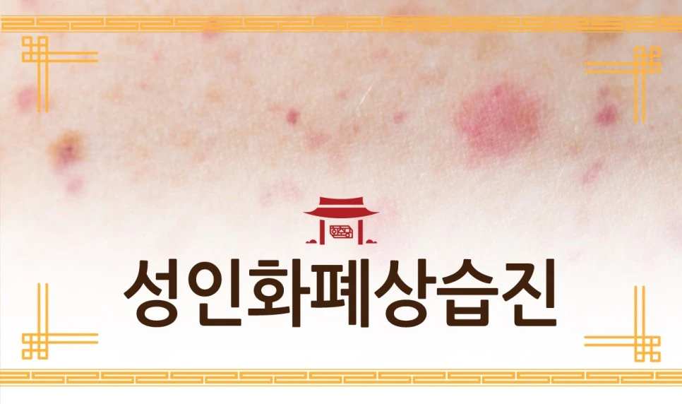 231221_%EC%84%B1%EC%9D%B8%ED%99%94%ED%8F%90%EC%83%81%EC%8A%B5%EC%A7%8401.jpg?type=w966