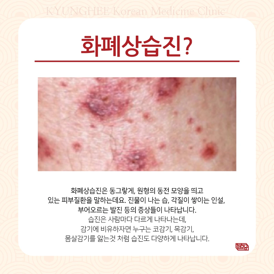 231221_%EC%84%B1%EC%9D%B8%ED%99%94%ED%8F%90%EC%83%81%EC%8A%B5%EC%A7%8402.jpg?type=w966