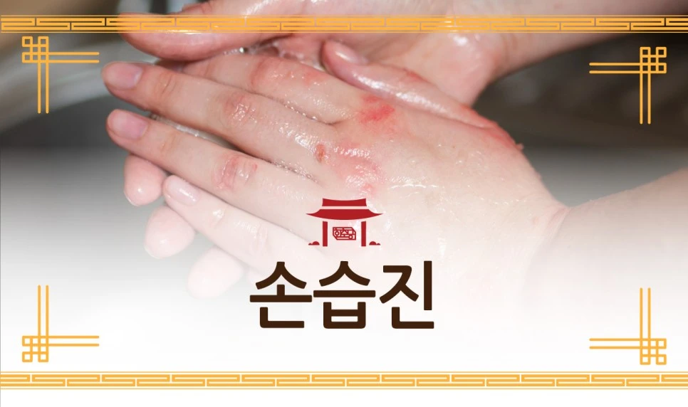 231127_%EC%86%90%EC%8A%B5%EC%A7%84%EA%B2%BD%ED%9D%AC%EB%A5%9801.jpg?type=w966