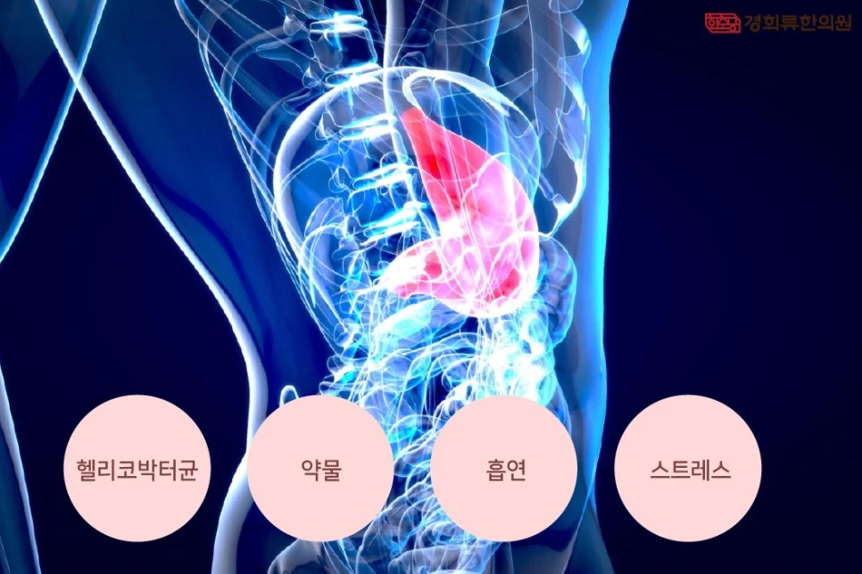 231005_%EC%9C%84%EA%B6%A4%EC%96%91%EC%9B%90%EC%9D%B8-%EA%B2%BD%ED%9D%AC%EB%A5%9803.jpg?type=w966