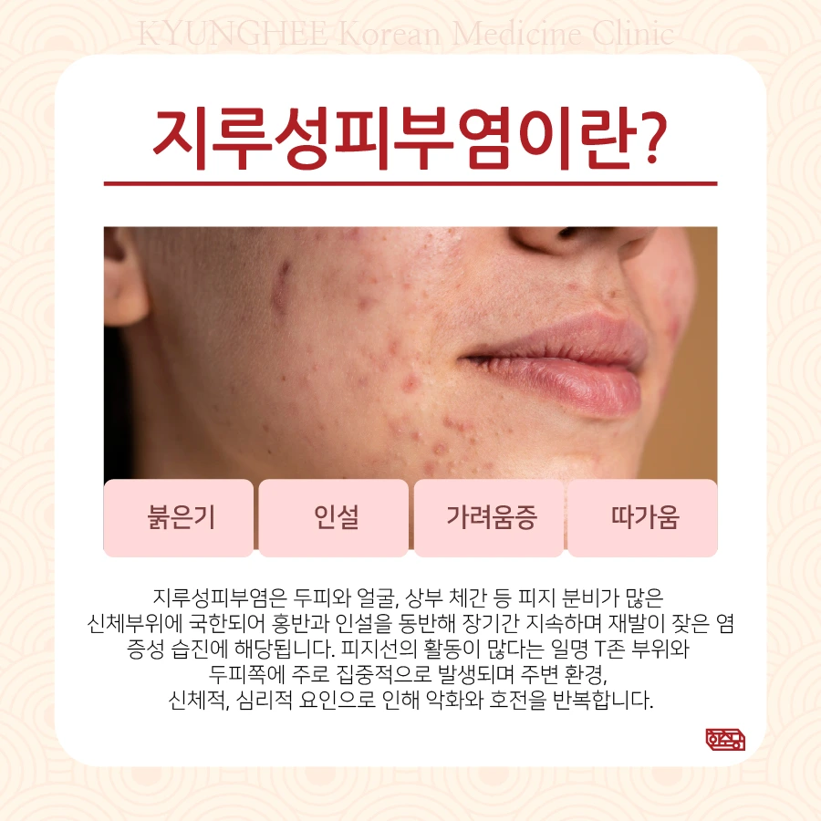 231129_%EC%A7%80%EB%A3%A8%EC%84%B1%ED%94%BC%EB%B6%80%EC%97%BC02.jpg?type=w966