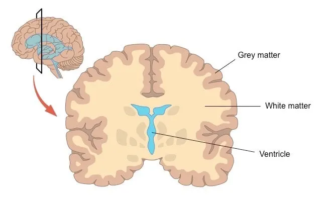 white-vs-grey-matter-2_med.jpeg