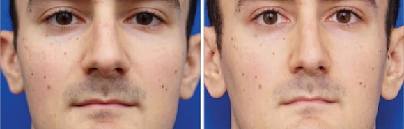 9985FD3F5A9DC7314223BE