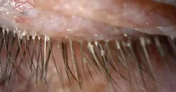 WhuW8BQX?format=jpg&amp;name=600x314