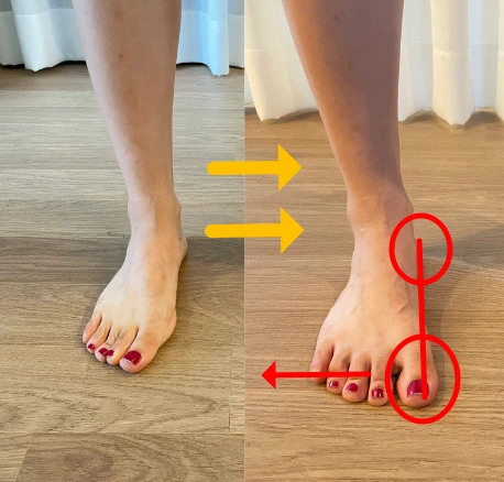 %EB%AC%B4%EC%A7%80%EC%99%B8%EB%B0%98%EC%A6%9D_3.png?type=w773