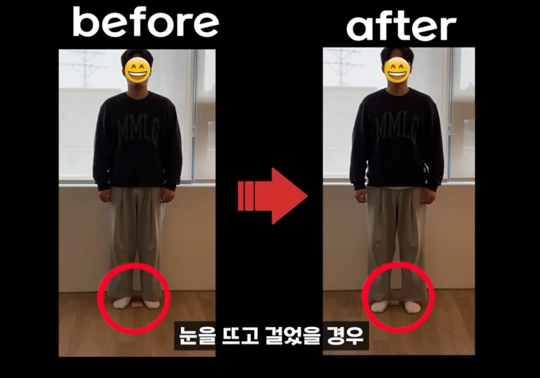 %EB%88%88%EB%9C%A8%EA%B3%A0.png?type=w773