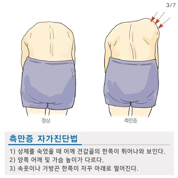 %EC%B2%99%EC%B6%94%EC%B8%A1%EB%A7%8C%EC%A6%9D_%EC%9E%90%EA%B0%80%EC%A7%84%EB%8B%A83.jpg?type=w1200