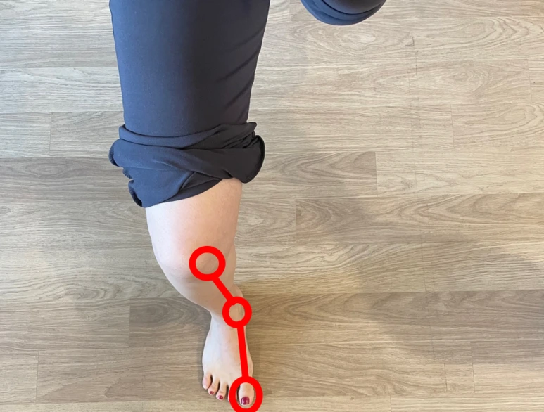 %EB%AC%B4%EC%A7%80%EC%99%B8%EB%B0%98%EC%A6%9D_%EC%9A%B4%EB%8F%99__%EC%A0%95%EB%A0%AC.png?type=w773