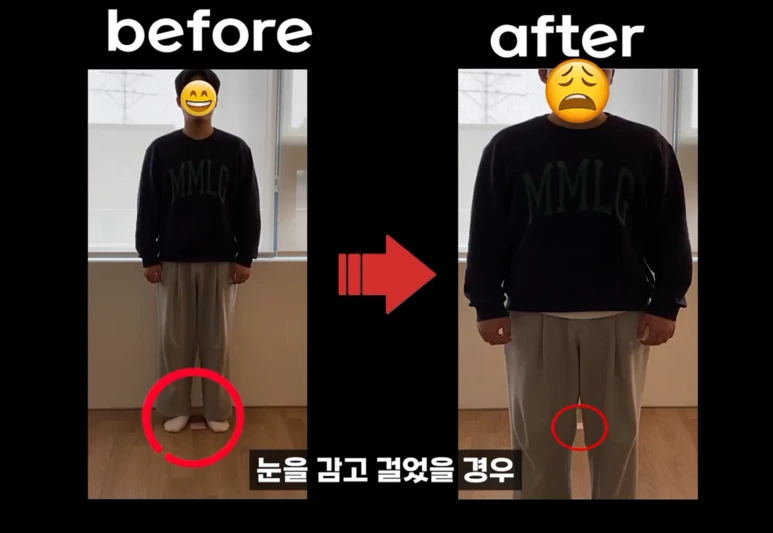 %EB%88%88%EA%B0%90%EA%B3%A0.png?type=w773