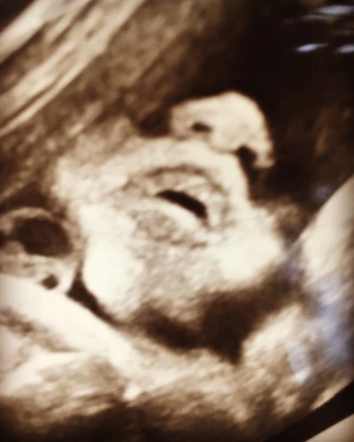 image_5683975861479490141839.jpg?type=w773