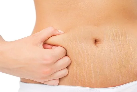 image_8326551051499899414503.jpg?type=w1200