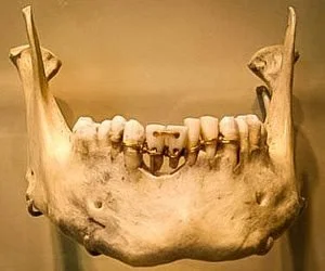 ford-mandible-300x250.jpg?type=w1200
