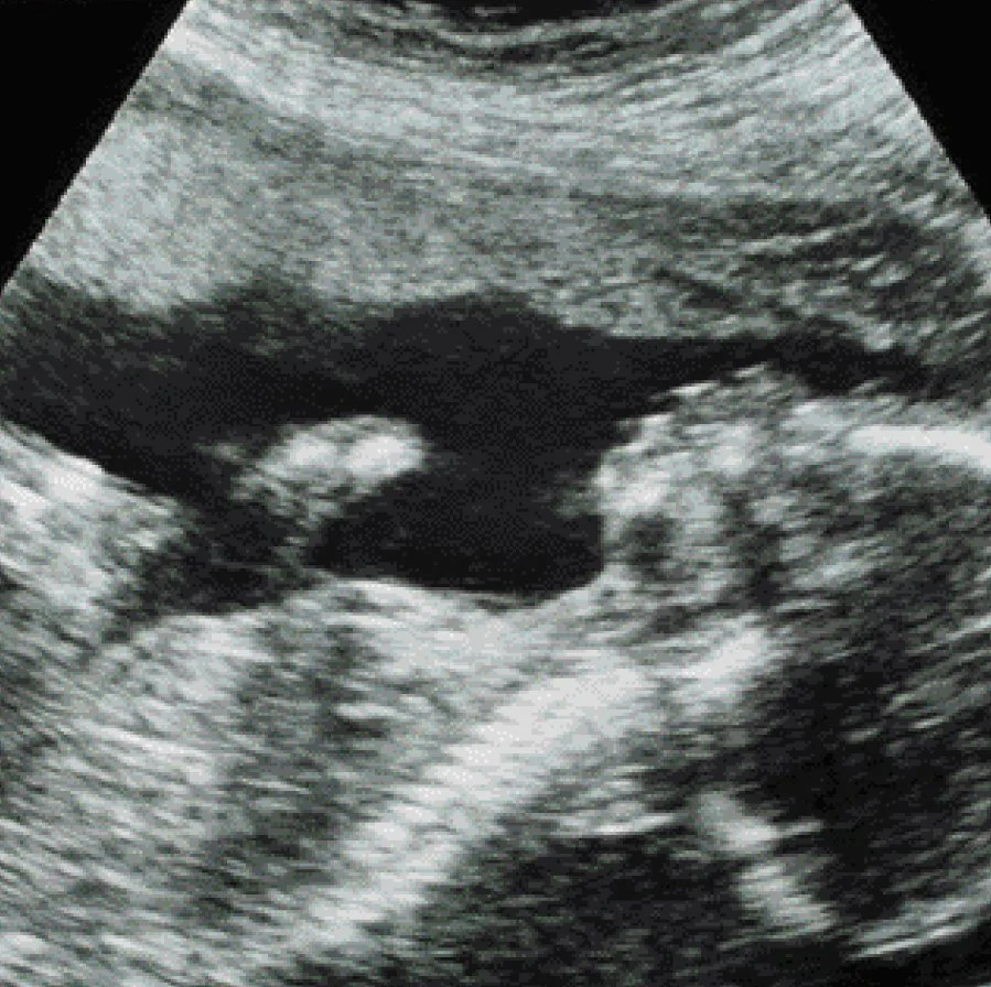 image_6276074251489050074503.jpg?type=w1200