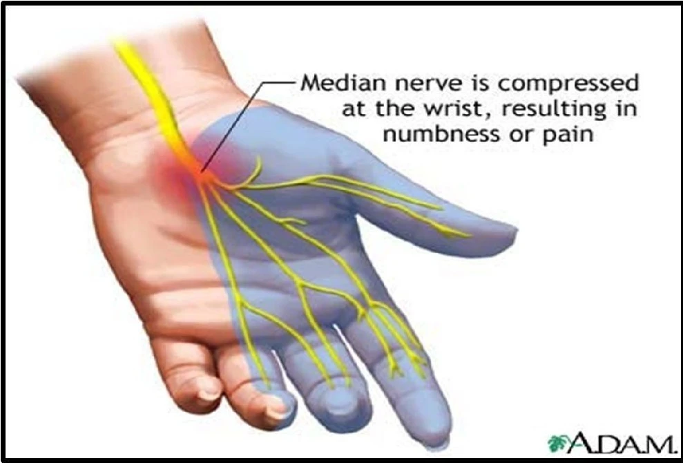 a_79dUd018svcjy6ptkwafeqn_fhiltn.png?type=e1920_std