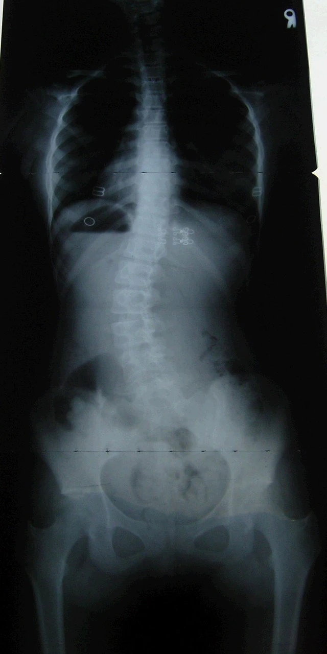 7_1c0Ud018svc2l8x9uqu49s0_fhiltn.png?type=e1920_std