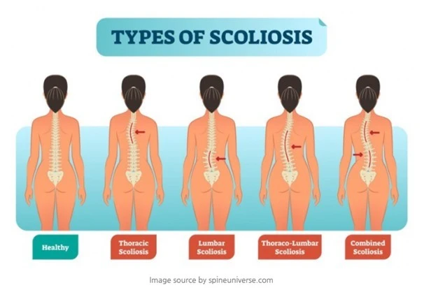 0_gc1Ud018svc1gzvuhsuptzat_fhiltn.png?type=e1920_std