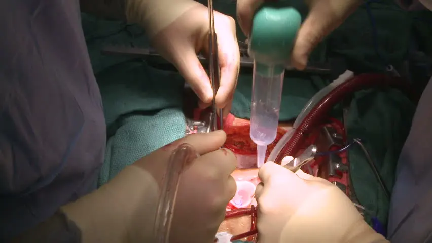 이리게이션 외과적.jpeg