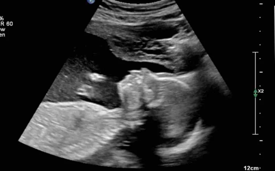 %EB%A8%B8%EB%A6%AC.jpg?type=w966