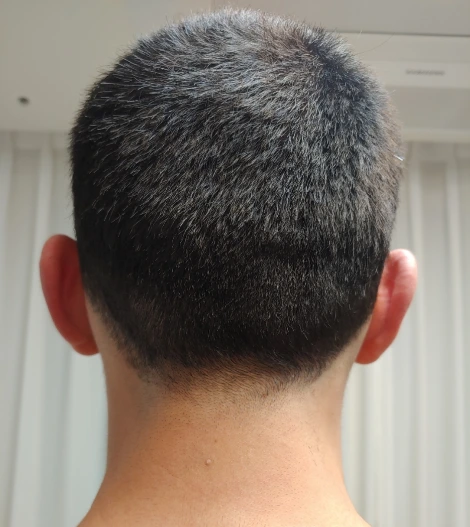 SE-bf9348c7-2202-4f9b-a59a-0128c872acf1.png?type=w1