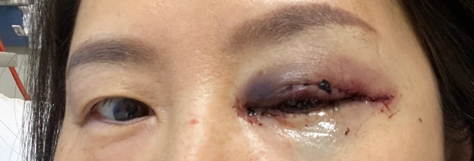 SE-3ccdcf90-5dd3-4d6e-a246-b5dda3b6a11d.jpg?type=w966