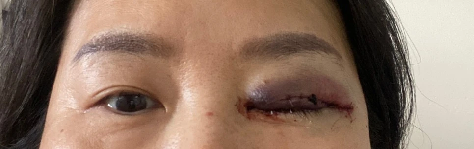 SE-de12174e-2e44-47db-b67a-1c04173a1853.jpg?type=w966